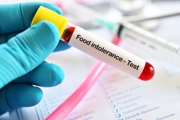 ALCAT Platinum Plus Test: 370 items tested (food, herbs, mold and more)