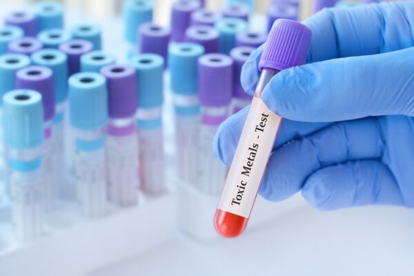 Toxin and Essential Elements Profile- Finger Blood Spot Test